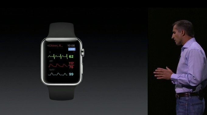 Airstrip Fetal Monitor Running on Apple WatchOS 2