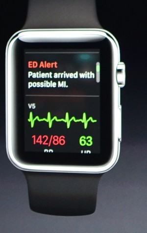 iWatch app alerts MD to ER Patient Admission